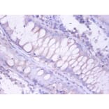 Immunohistochemistry - Proteasome subunit beta type-4 Polyclonal Antibody from Signalway Antibody (42251)