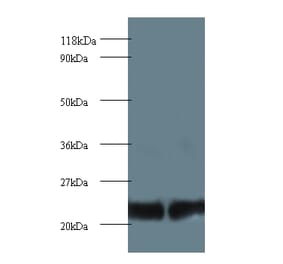 Proteasome subunit beta type-2 Polyclonal Antibody from Signalway Antibody (42252) - Antibodies.com