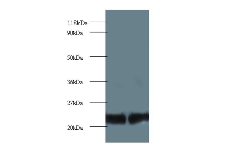 Proteasome subunit beta type-2 Polyclonal Antibody from Signalway Antibody (42252) - Antibodies.com