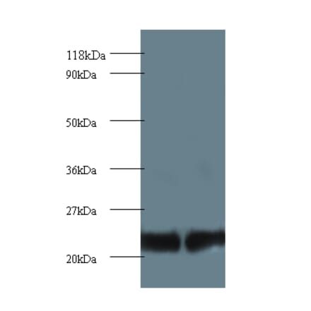 Proteasome subunit beta type-2 Polyclonal Antibody from Signalway Antibody (42252) - Antibodies.com