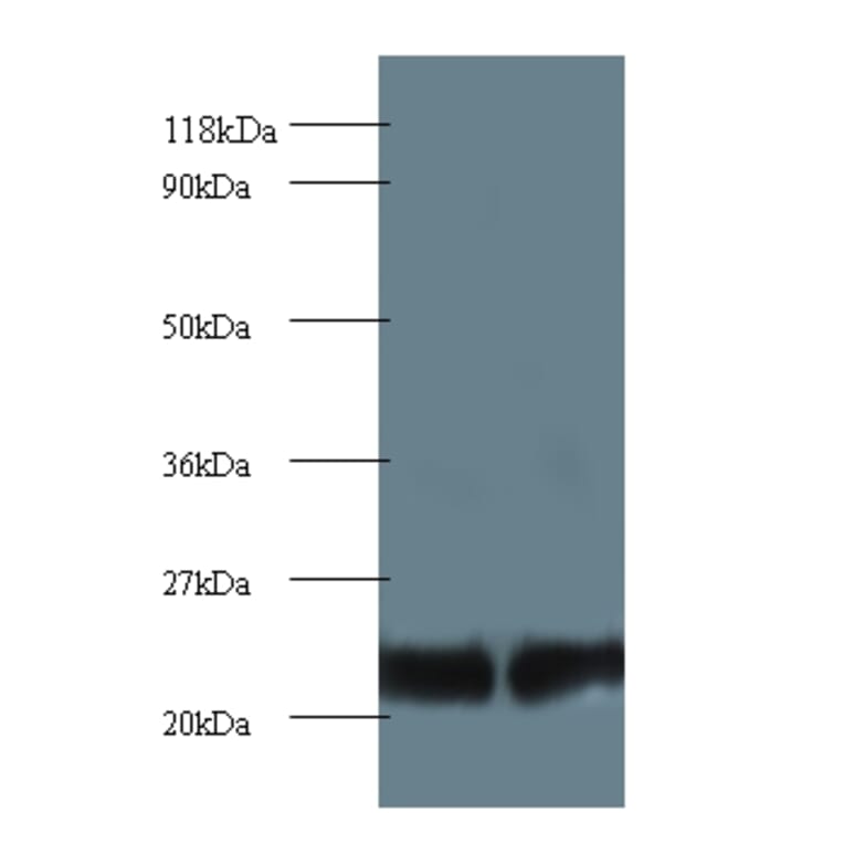 Proteasome subunit beta type-2 Polyclonal Antibody from Signalway Antibody (42252) - Antibodies.com