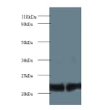 Proteasome subunit beta type-2 Polyclonal Antibody from Signalway Antibody (42252) - Antibodies.com