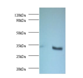 NADH-cytochrome b5 reductase 3 Polyclonal Antibody from Signalway Antibody (42369) - Antibodies.com