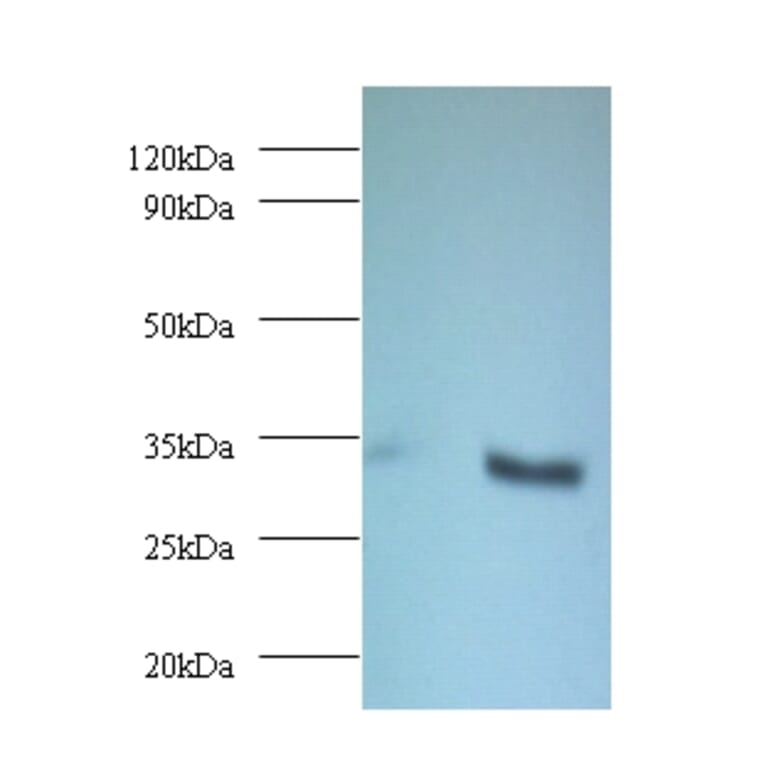 NADH-cytochrome b5 reductase 3 Polyclonal Antibody from Signalway Antibody (42369) - Antibodies.com