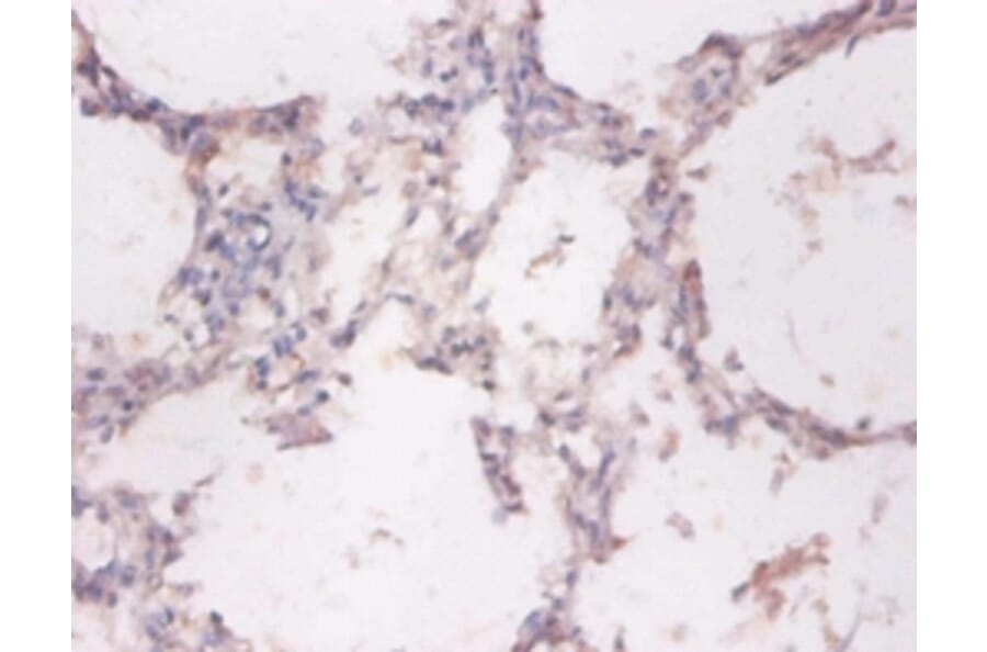 Immunohistochemistry - NADH-cytochrome b5 reductase 3 Polyclonal Antibody from Signalway Antibody (42369)