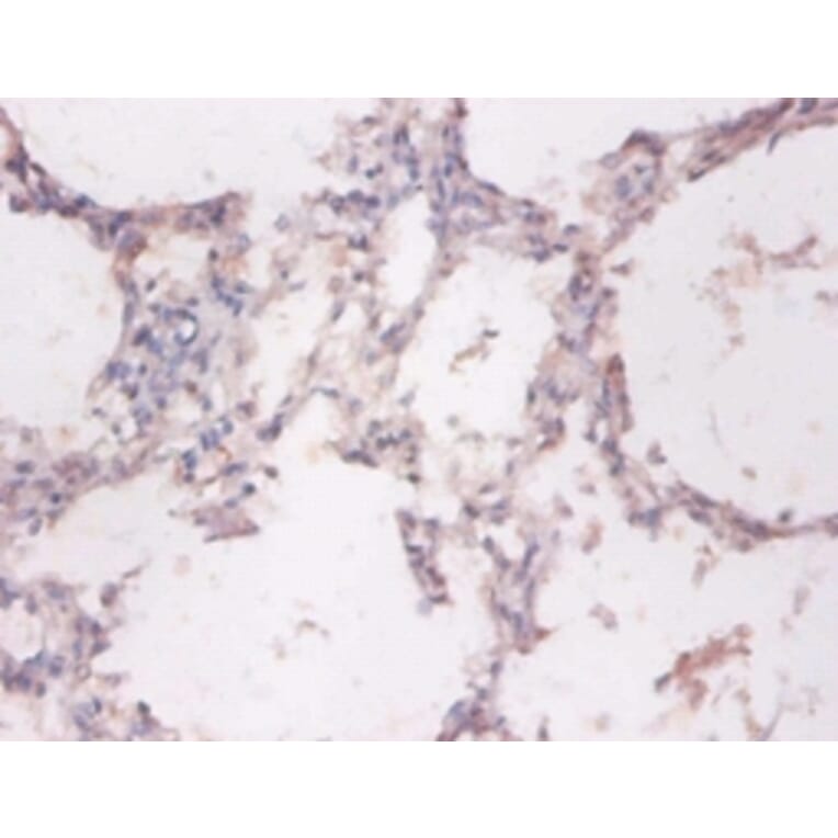 Immunohistochemistry - NADH-cytochrome b5 reductase 3 Polyclonal Antibody from Signalway Antibody (42369)