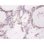 Immunohistochemistry - NADH-cytochrome b5 reductase 3 Polyclonal Antibody from Signalway Antibody (42369)
