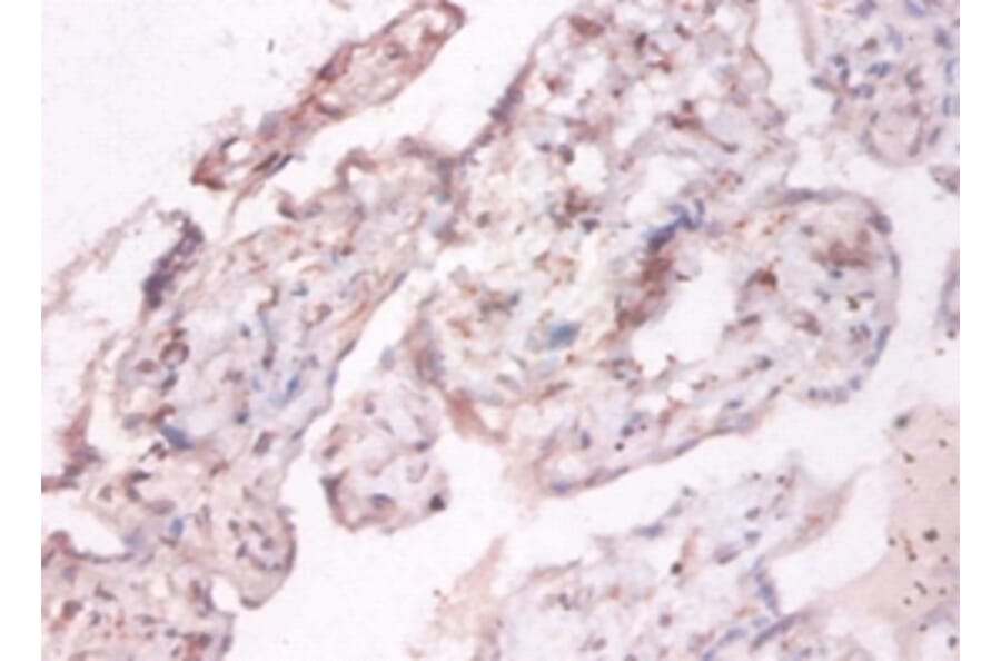 Immunohistochemistry - NADH-cytochrome b5 reductase 3 Polyclonal Antibody from Signalway Antibody (42369)