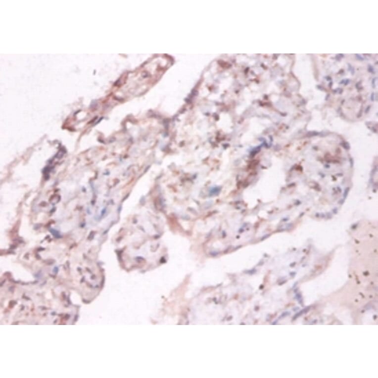 Immunohistochemistry - NADH-cytochrome b5 reductase 3 Polyclonal Antibody from Signalway Antibody (42369)