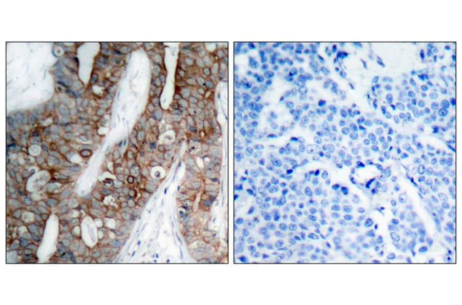 Immunohistochemistry - Integrin b3 (Ab-773) Antibody from Signalway Antibody (21082) - Antibodies.com
