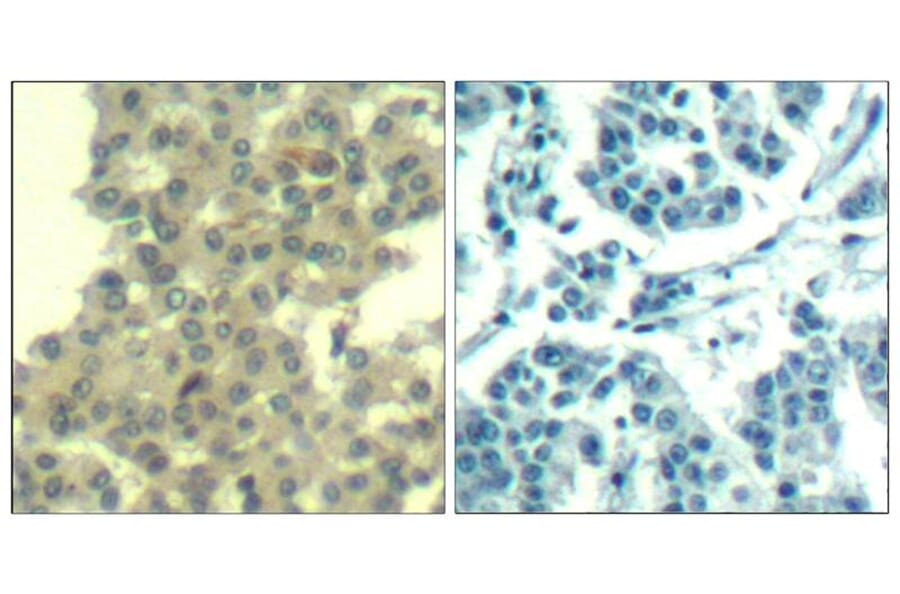 Immunohistochemistry - Her3/ErbB3 (Ab-1328) Antibody from Signalway Antibody (21510) - Antibodies.com