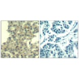 Immunohistochemistry - Her3/ErbB3 (Ab-1328) Antibody from Signalway Antibody (21510) - Antibodies.com