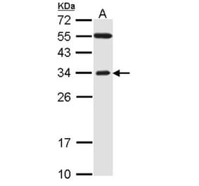 F-box only protein 2 antibody from Signalway Antibody (22456) - Antibodies.com