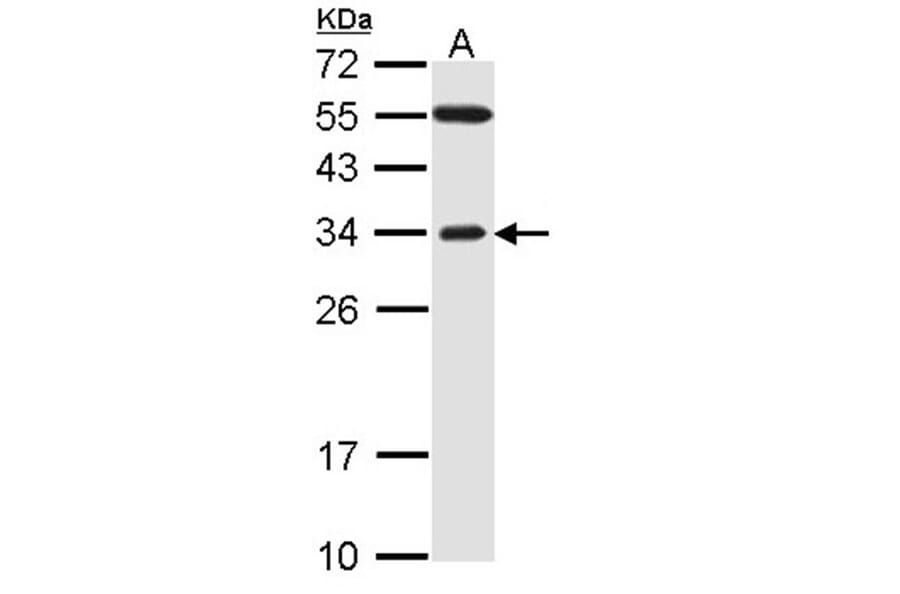 F-box only protein 2 antibody from Signalway Antibody (22456) - Antibodies.com