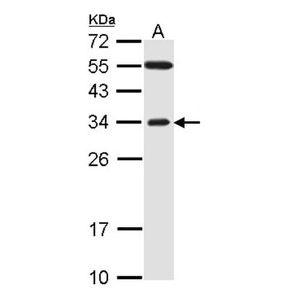 F-box only protein 2 antibody from Signalway Antibody (22456) - Antibodies.com