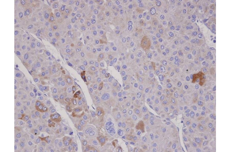 Immunohistochemistry - F-box only protein 2 antibody from Signalway Antibody (22456) - Antibodies.com