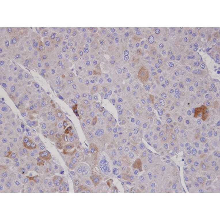 Immunohistochemistry - F-box only protein 2 antibody from Signalway Antibody (22456) - Antibodies.com