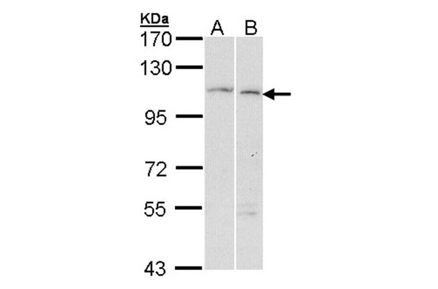 alpha Glucosidase II antibody from Signalway Antibody (22650) - Antibodies.com