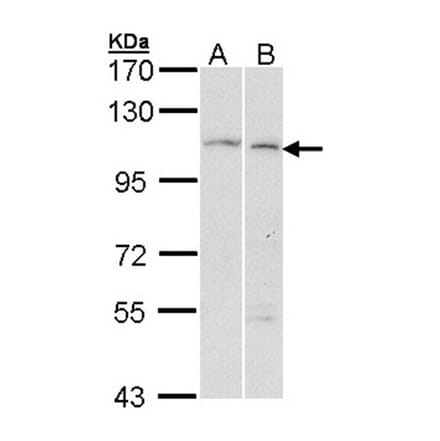 alpha Glucosidase II antibody from Signalway Antibody (22650) - Antibodies.com