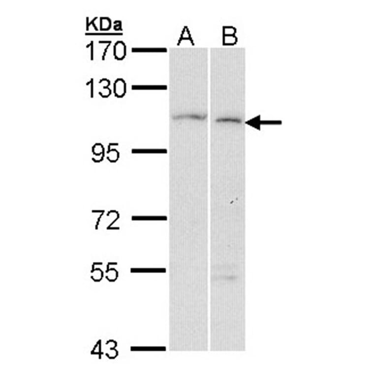 alpha Glucosidase II antibody from Signalway Antibody (22650) - Antibodies.com