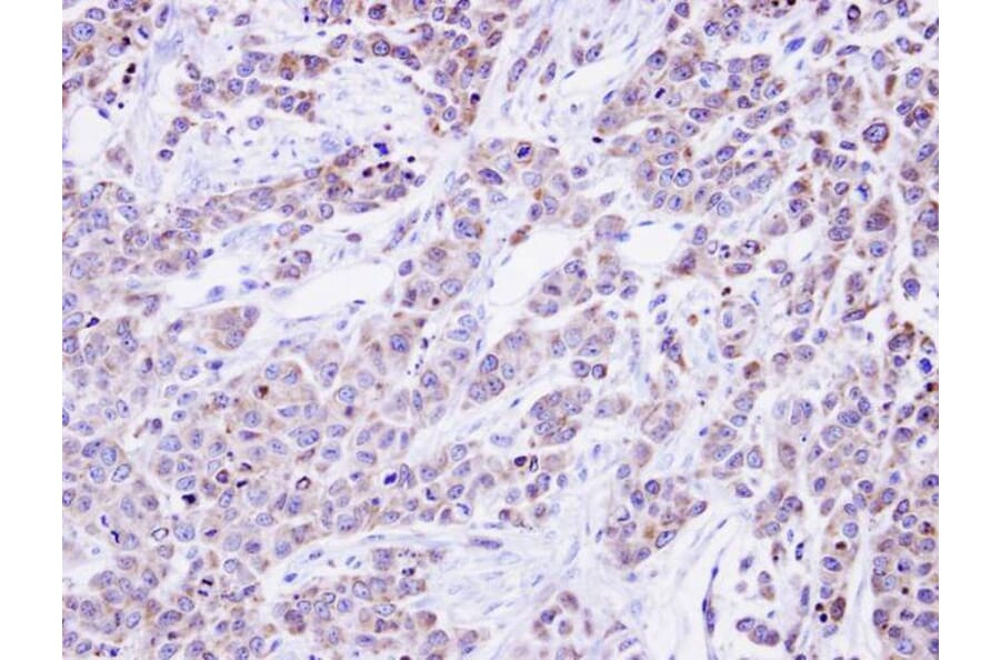 Immunohistochemistry - alpha Glucosidase II antibody from Signalway Antibody (22650) - Antibodies.com
