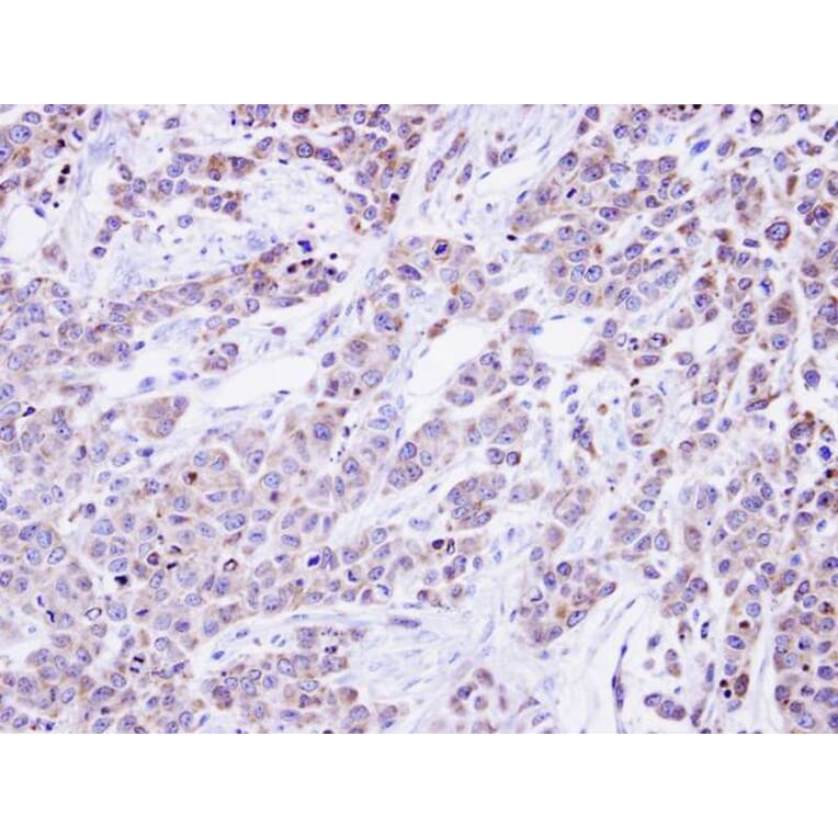Immunohistochemistry - alpha Glucosidase II antibody from Signalway Antibody (22650) - Antibodies.com