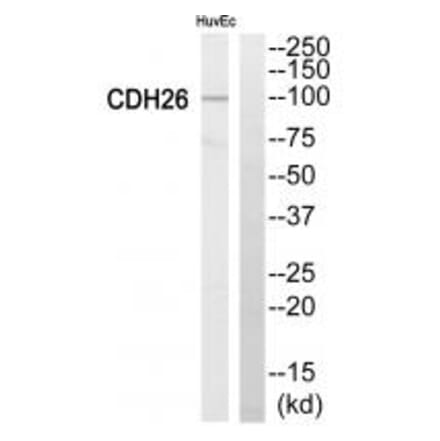 Western blot - Cytochrome P450 2C8 Antibody from Signalway Antibody (34235) - Antibodies.com