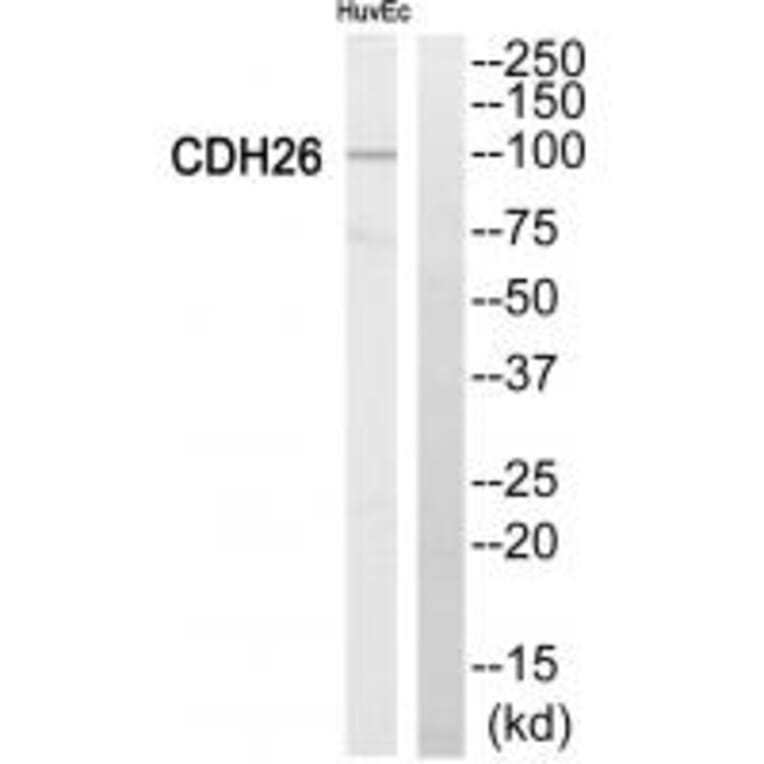 Western blot - Cytochrome P450 2C8 Antibody from Signalway Antibody (34235) - Antibodies.com