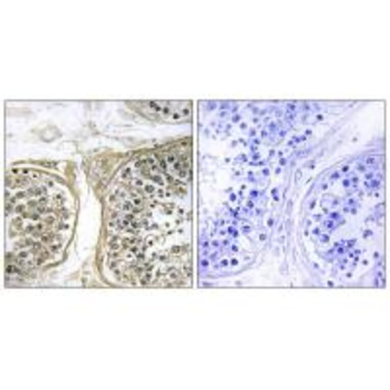 Immunohistochemistry - Cytochrome P450 2C8 Antibody from Signalway Antibody (34235) - Antibodies.com