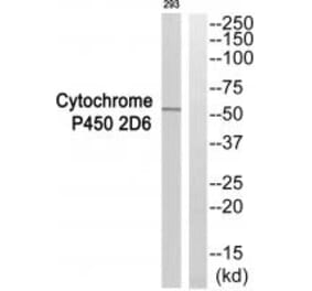 Western blot - Cytochrome P450 2D6 Antibody from Signalway Antibody (35268) - Antibodies.com