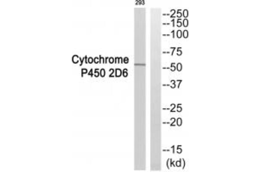 Western blot - Cytochrome P450 2D6 Antibody from Signalway Antibody (35268) - Antibodies.com