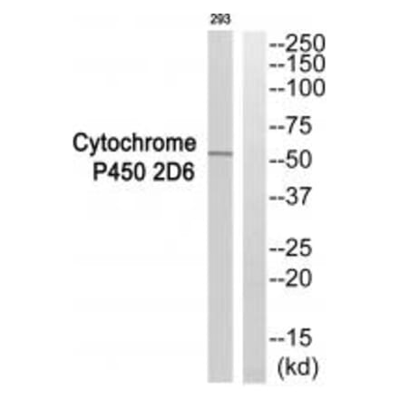 Western blot - Cytochrome P450 2D6 Antibody from Signalway Antibody (35268) - Antibodies.com