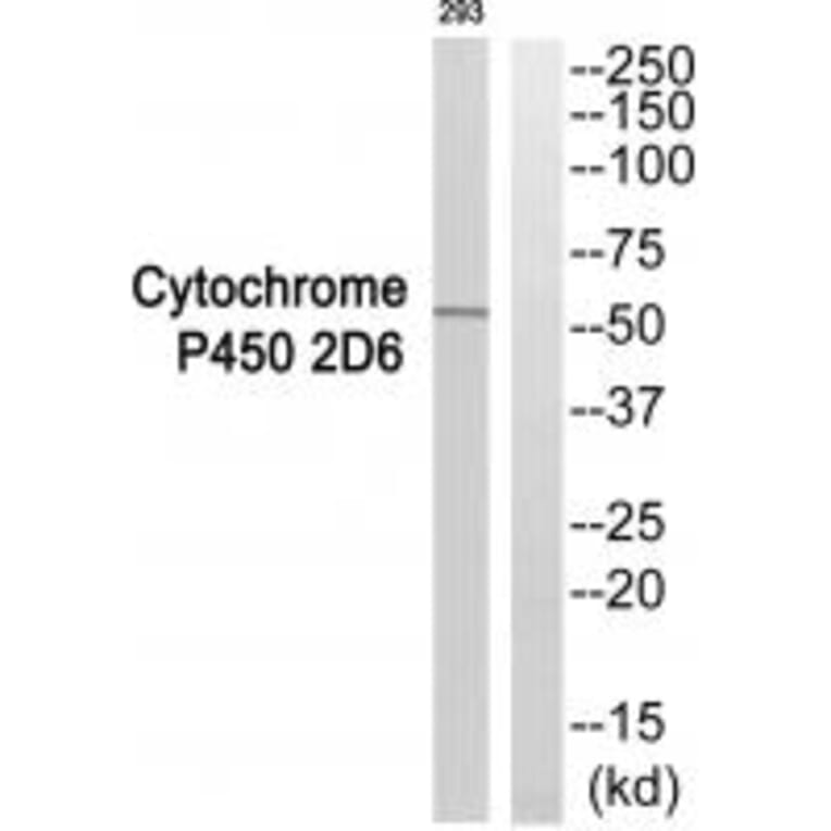 Western blot - Cytochrome P450 2D6 Antibody from Signalway Antibody (35268) - Antibodies.com