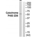 Western blot - Cytochrome P450 2D6 Antibody from Signalway Antibody (35268) - Antibodies.com