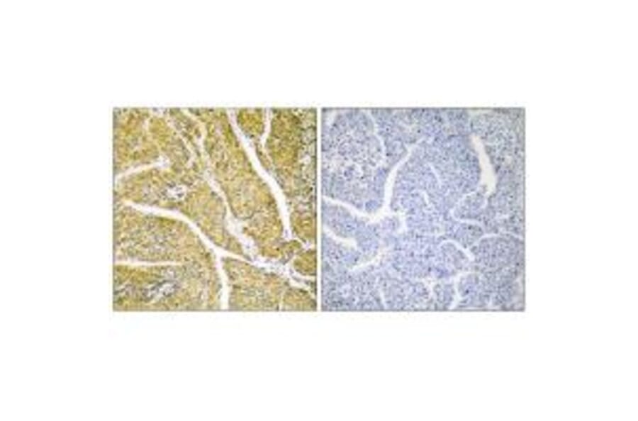 Immunohistochemistry - Cytochrome P450 2D6 Antibody from Signalway Antibody (35268) - Antibodies.com