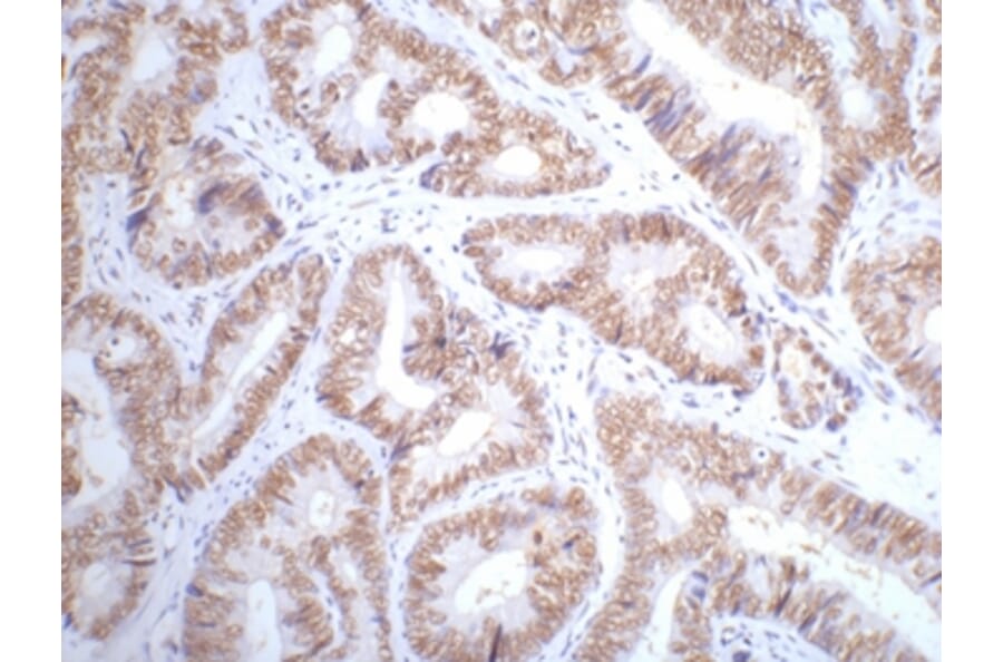 p53 Mouse Monoclonal Antibody from Signalway Antibody (38007) - Antibodies.com