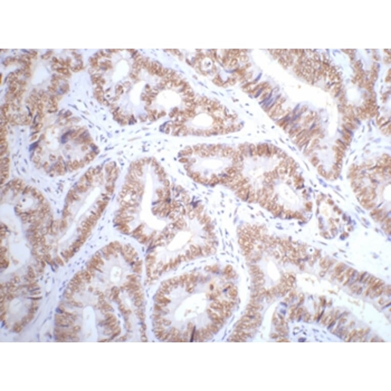 p53 Mouse Monoclonal Antibody from Signalway Antibody (38007) - Antibodies.com