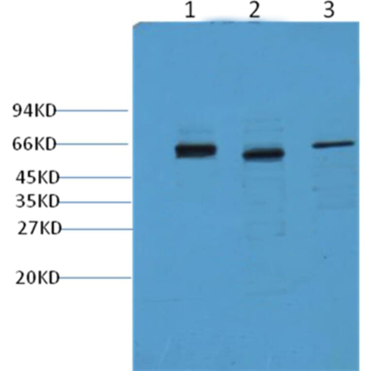 Western blot - CK7 Mouse Monoclonal Antibody from Signalway Antibody (38009) - Antibodies.com