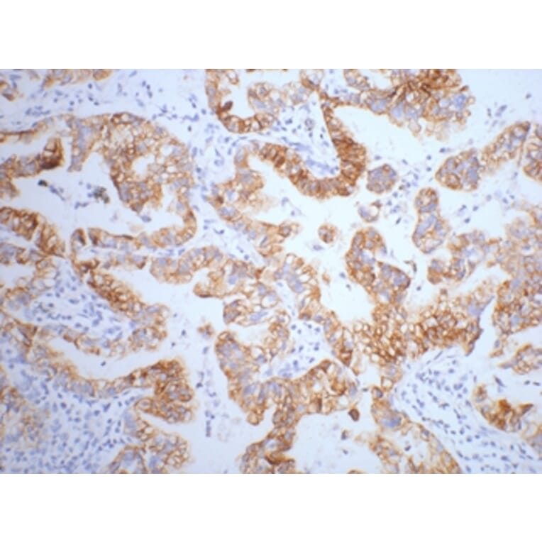 CK7 Mouse Monoclonal Antibody from Signalway Antibody (38009) - Antibodies.com