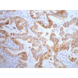 CK7 Mouse Monoclonal Antibody from Signalway Antibody (38009) - Antibodies.com
