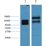 Western blot - CK8 Mouse Monoclonal Antibody from Signalway Antibody (38010) - Antibodies.com
