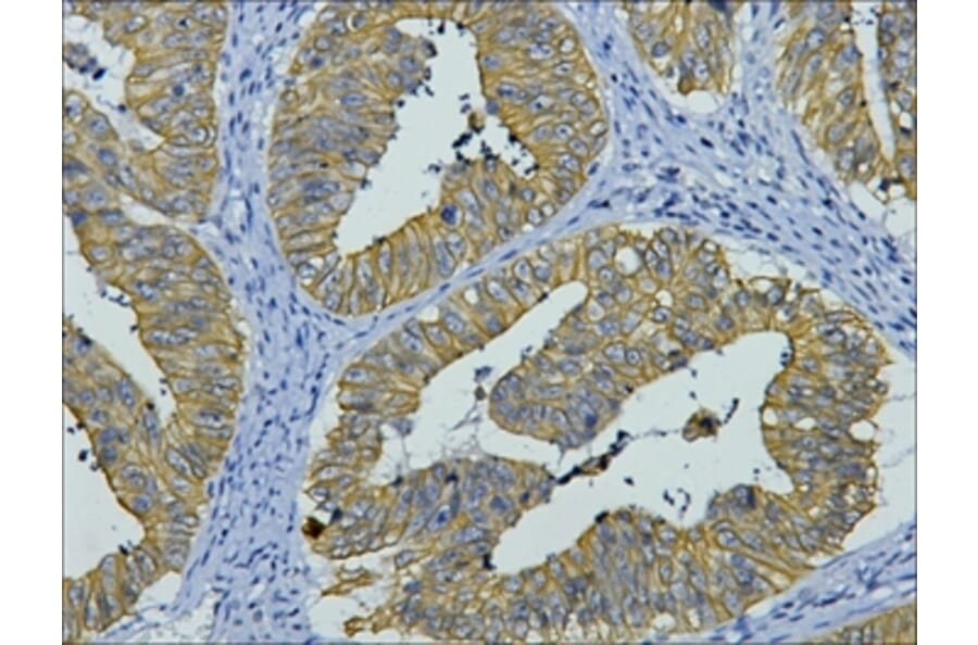 CK8 Mouse Monoclonal Antibody from Signalway Antibody (38010) - Antibodies.com
