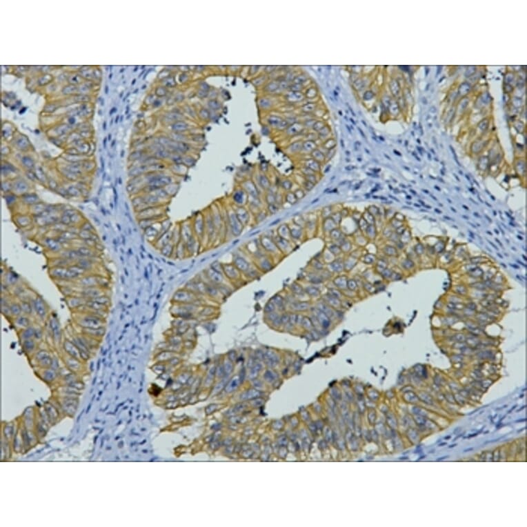 CK8 Mouse Monoclonal Antibody from Signalway Antibody (38010) - Antibodies.com
