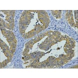 CK8 Mouse Monoclonal Antibody from Signalway Antibody (38010) - Antibodies.com