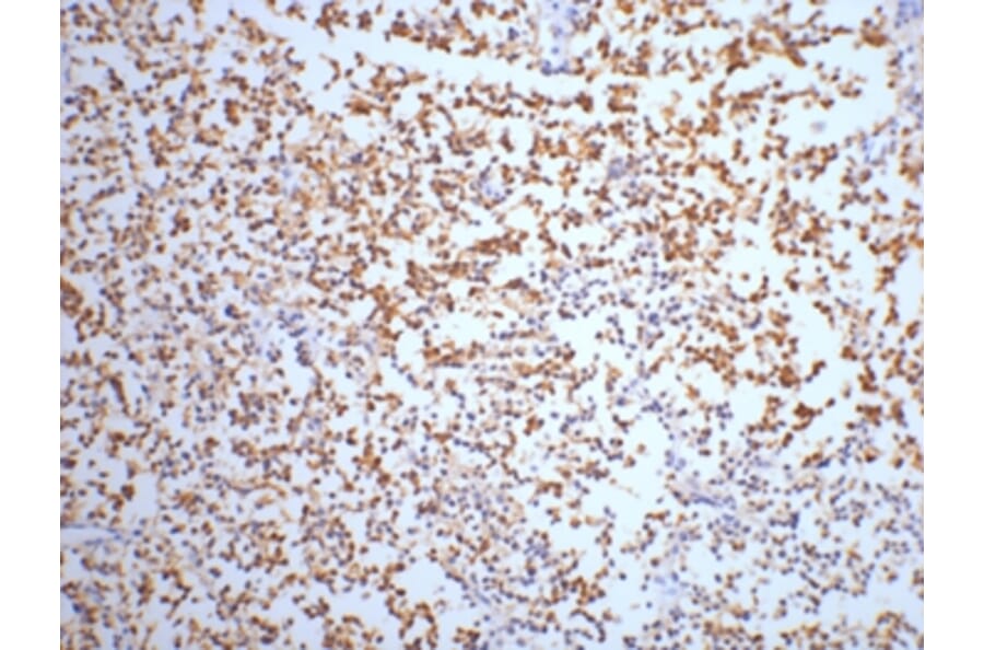 NSE Mouse Monoclonal Antibody from Signalway Antibody (38021) - Antibodies.com