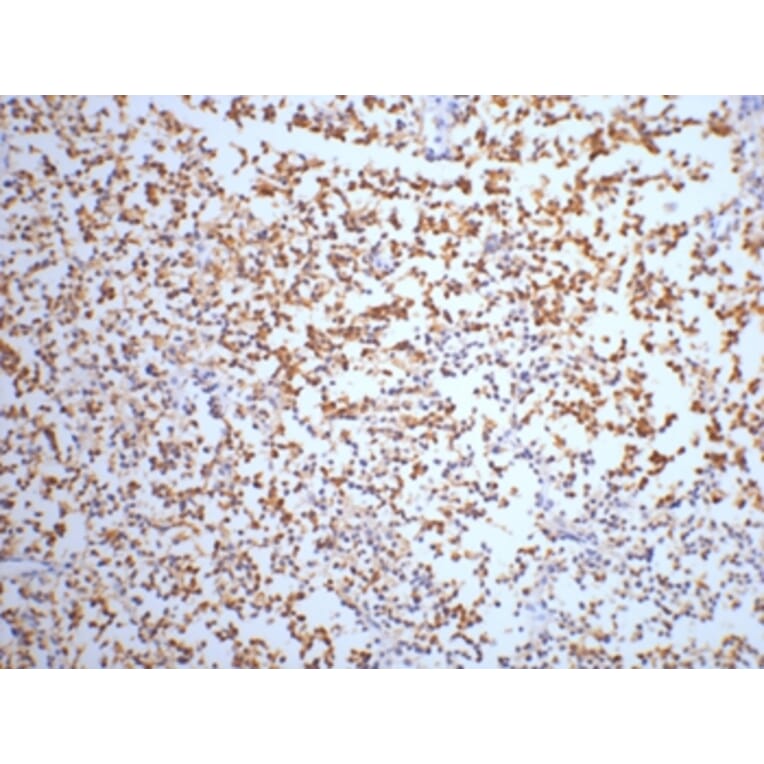 NSE Mouse Monoclonal Antibody from Signalway Antibody (38021) - Antibodies.com