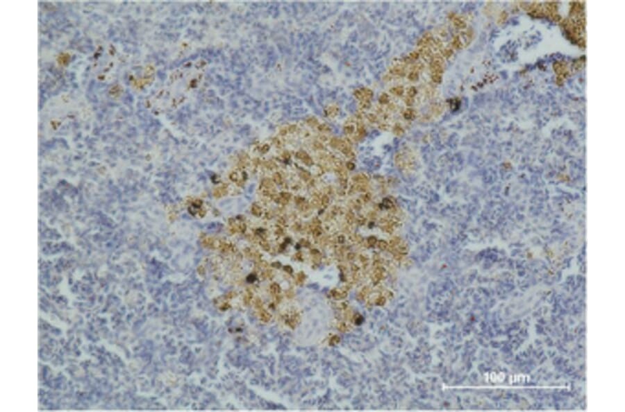 Immunohistochemistry - Caspase-8 Monoclonal Antibody from Signalway Antibody (40483) - Antibodies.com