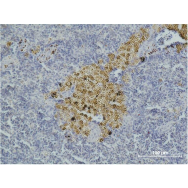 Immunohistochemistry - Caspase-8 Monoclonal Antibody from Signalway Antibody (40483) - Antibodies.com