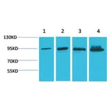 Western blot - Catenin-β Monoclonal Antibody from Signalway Antibody (40487) - Antibodies.com