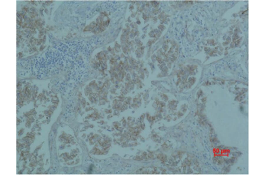 Immunohistochemistry - Catenin-β Monoclonal Antibody from Signalway Antibody (40487) - Antibodies.com